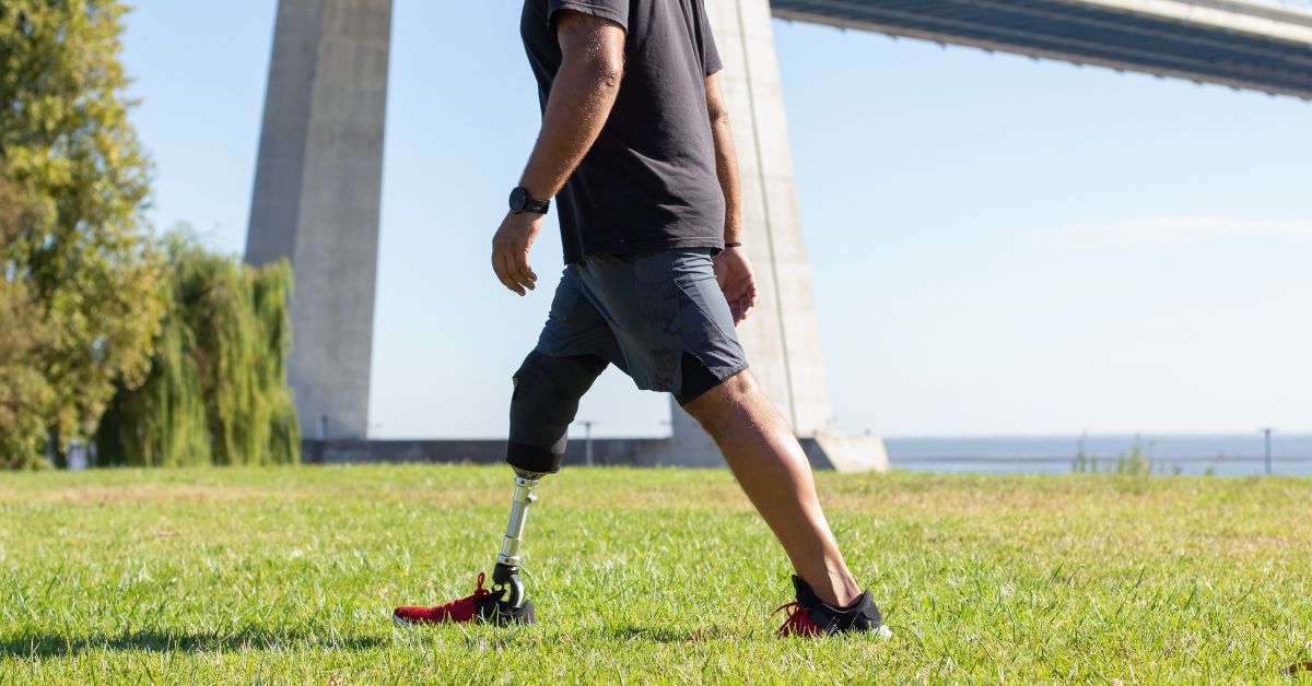 How to walk with a prosthetic leg a step by step guide 1